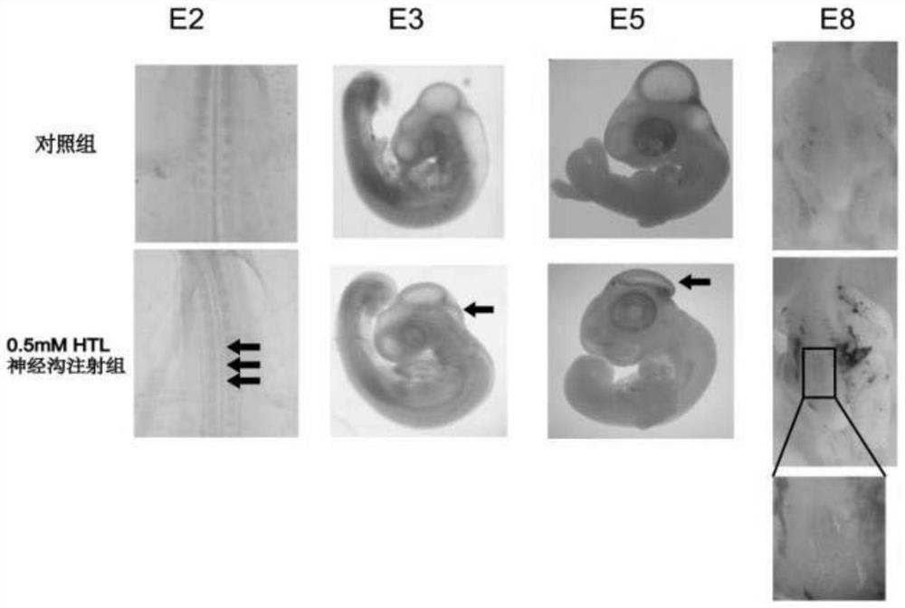 A method of constructing a neural tube defect model and its application
