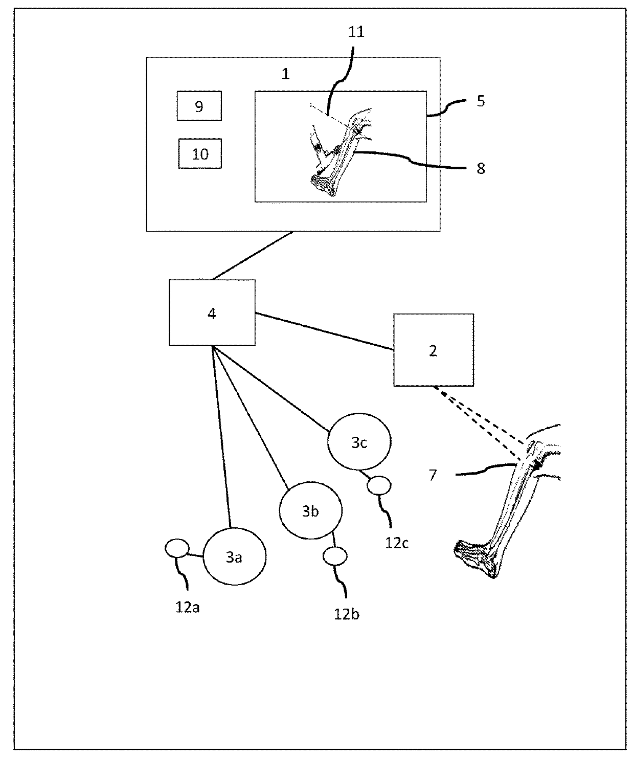 Method and system for computer assisted surgery