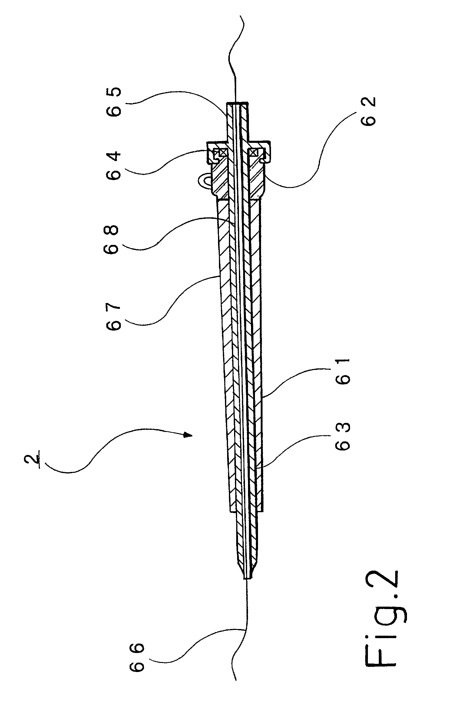 Intrapelvic perfusion therapy with cancer therapeutic agent and apparatus for intrapelvic perfusion with cancer therapeutic agent