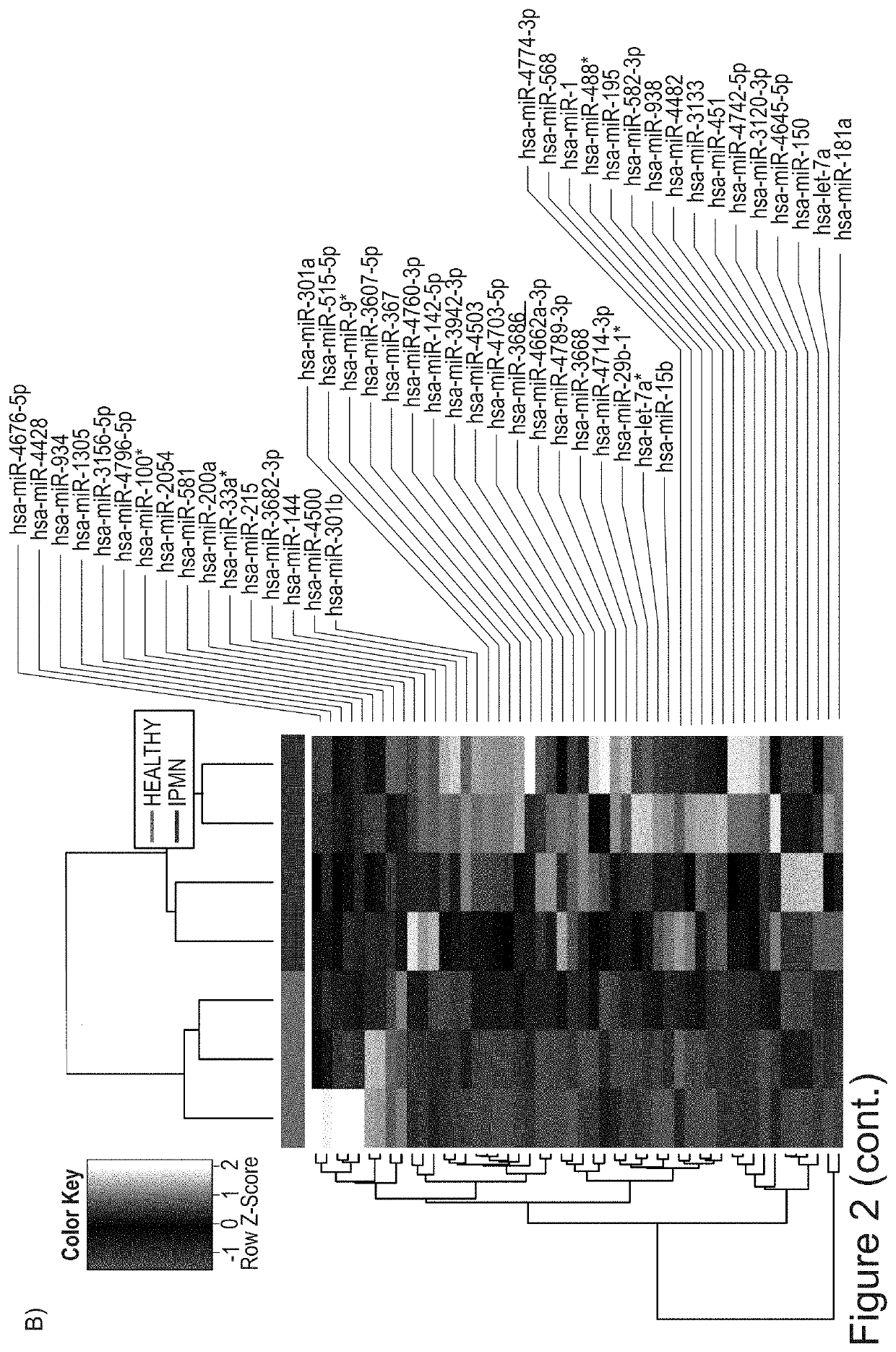 In vitro method for identifying pancreatic cancer or intraductal papillary mucinous neoplasm of the pancreas