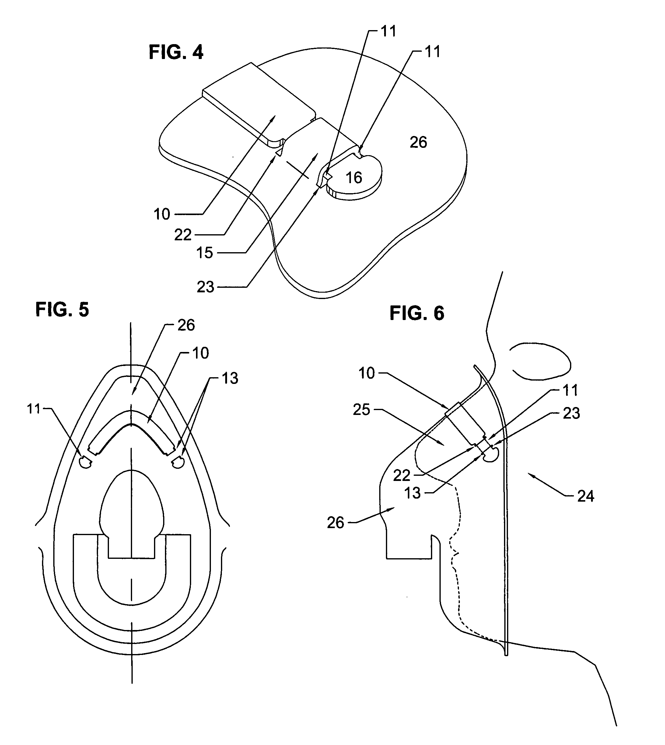 Attachment of a bridge band to an oxygen mask