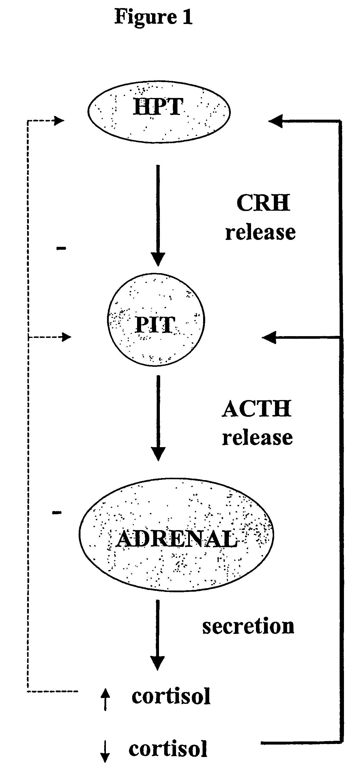 Sulphur analogues of 21-hydroxy-6,19-oxidoprogesterone (21OH-6OP) for treating excess of glucocorticoids