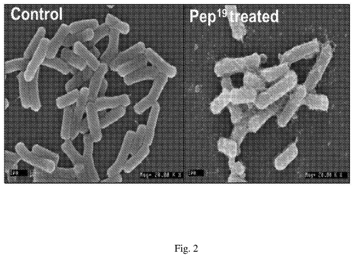 Antimicrobial peptide and its use thereof