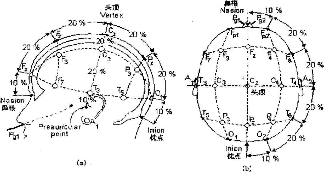 Robot equipment system for treating sleep apnea syndrome