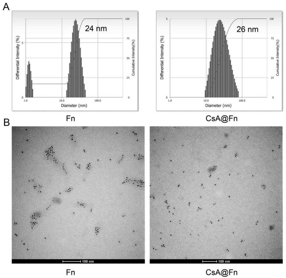 Preparation method and application of cyclosporine A-loaded efficient brain-targeted drug delivery system