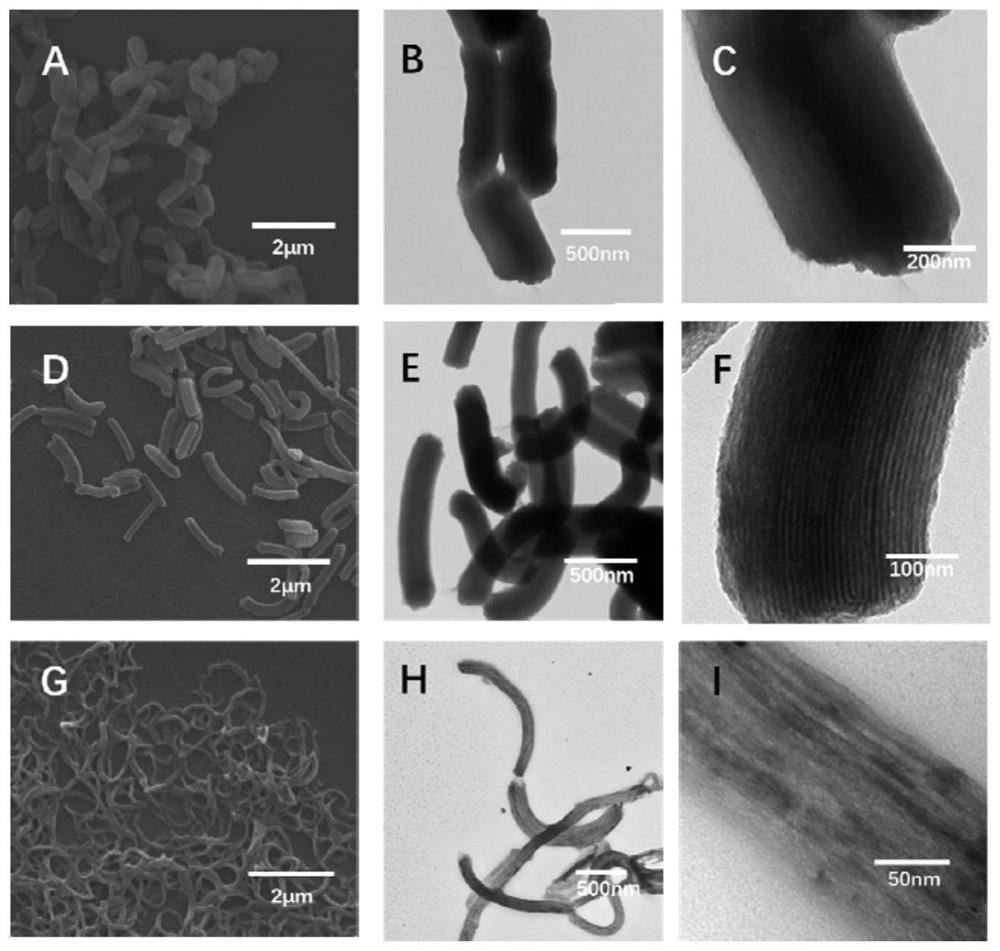 A kind of silica nanometer gene delivery system and its preparation method and application
