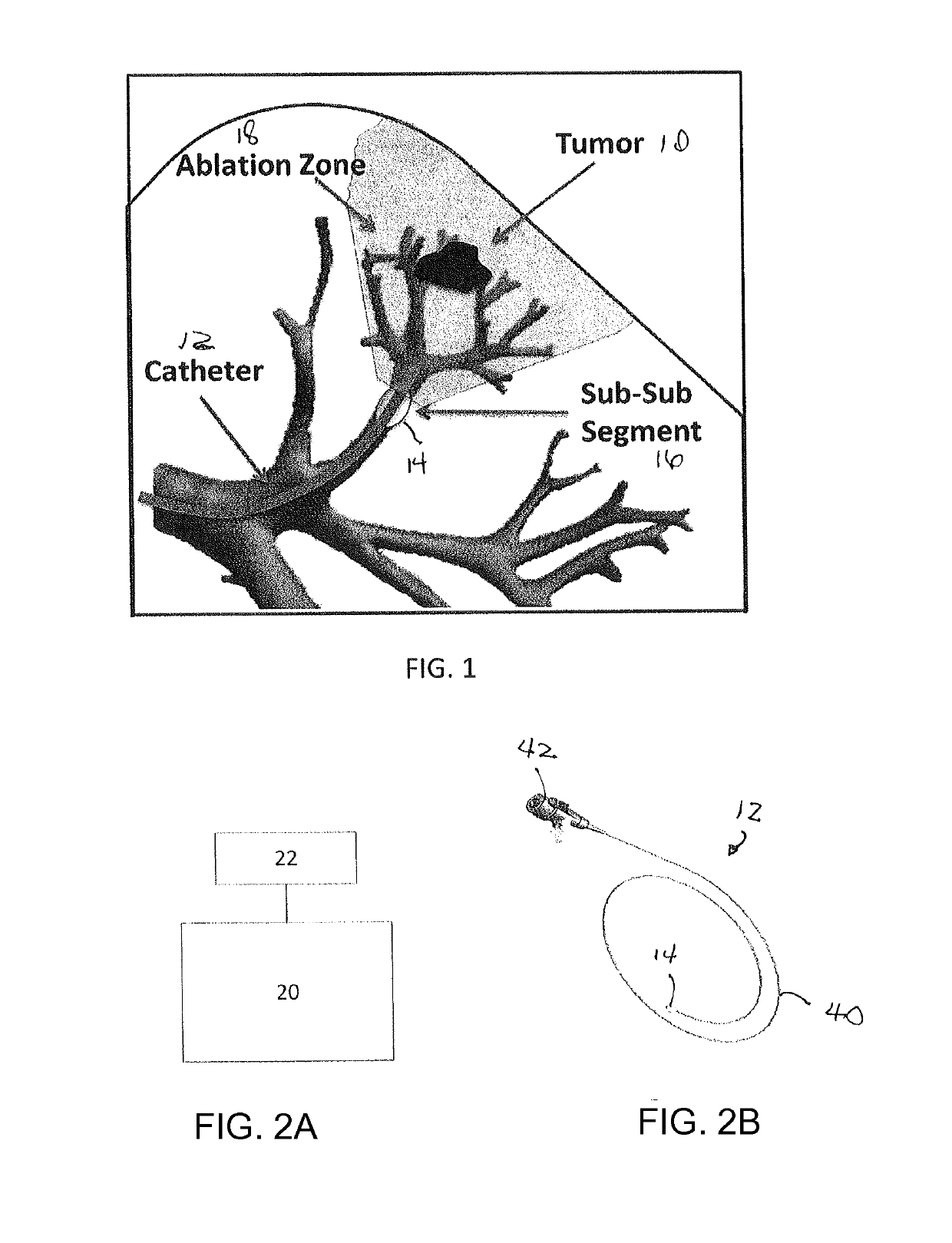 Vapor treatment of lung nodules and tumors