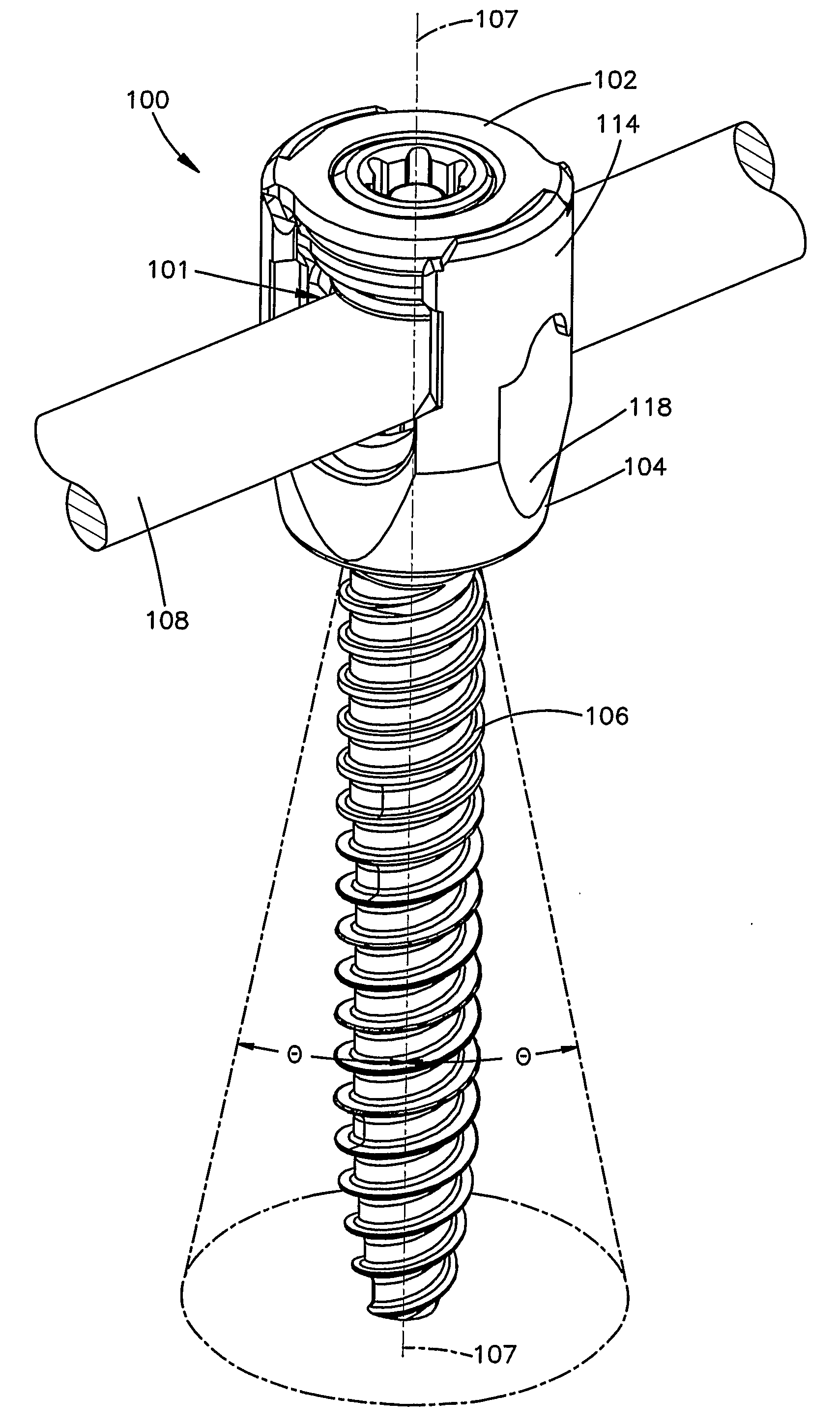 Bone Anchor With Locking Cap and Method of Spinal Fixation