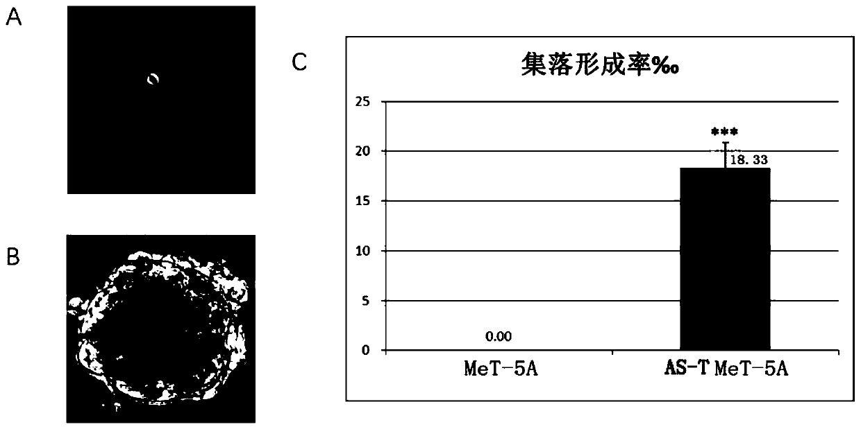 Chrysotile-induced human pleural mesothelial cell malignant transformation strain and application thereof