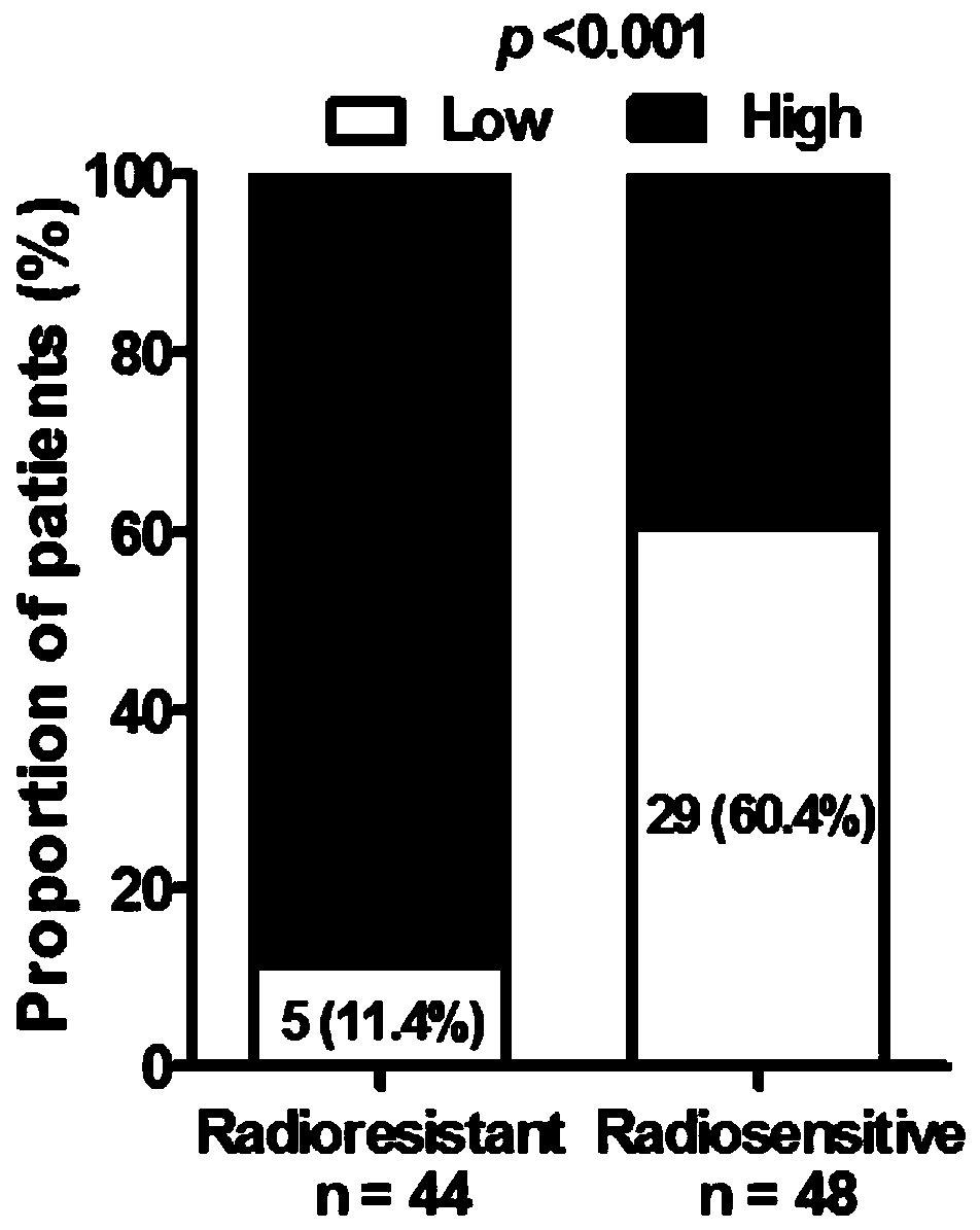 Application of reagents that interfere with the expression of long-chain non-coding RNA PVT1 in the preparation of radiosensitizers for nasopharyngeal carcinoma