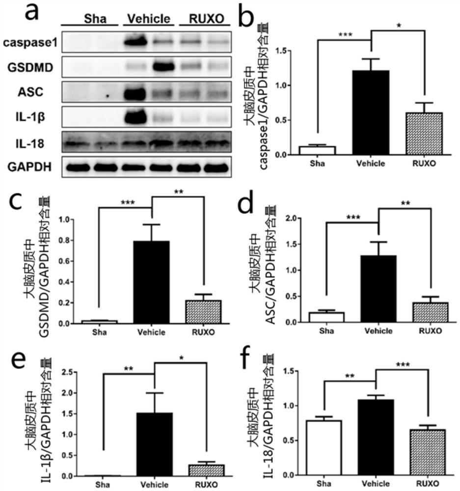 Application of jak-1 signal pathway inhibitor in preparation of medicine for treating brain injury