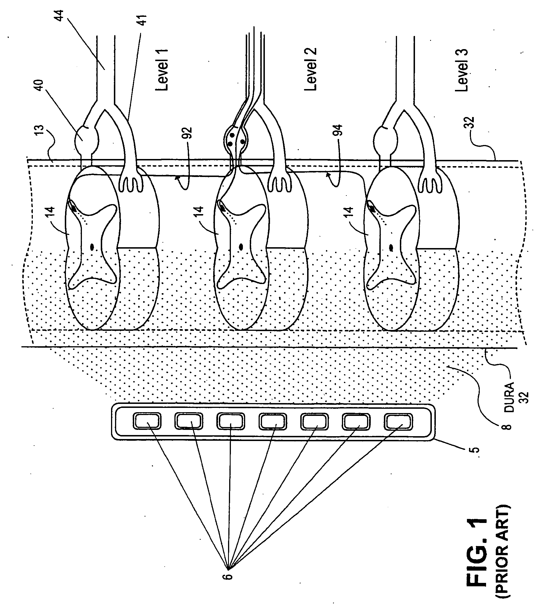Pulse generator for high impedance electrodes
