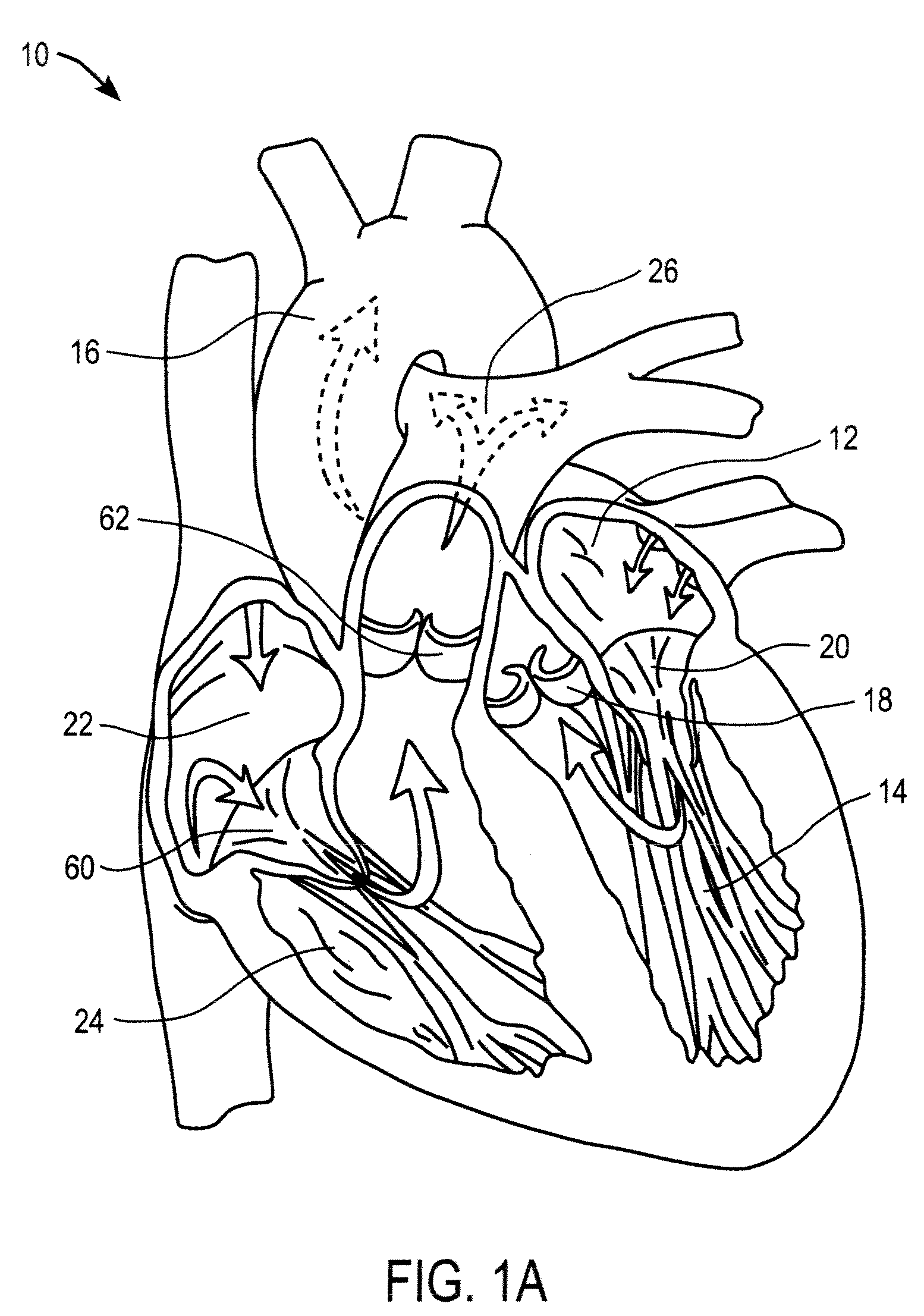 Apparatus and methods for heart valve repair