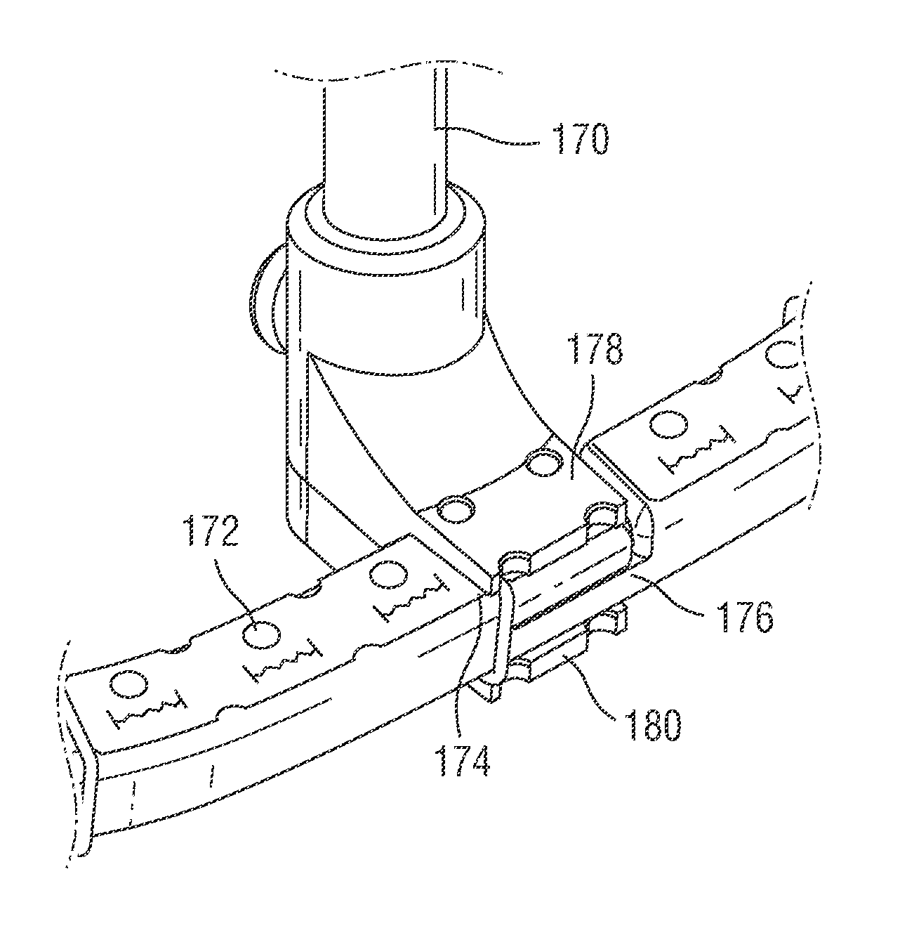 Collapsible cardiac implant and deployment system and methods