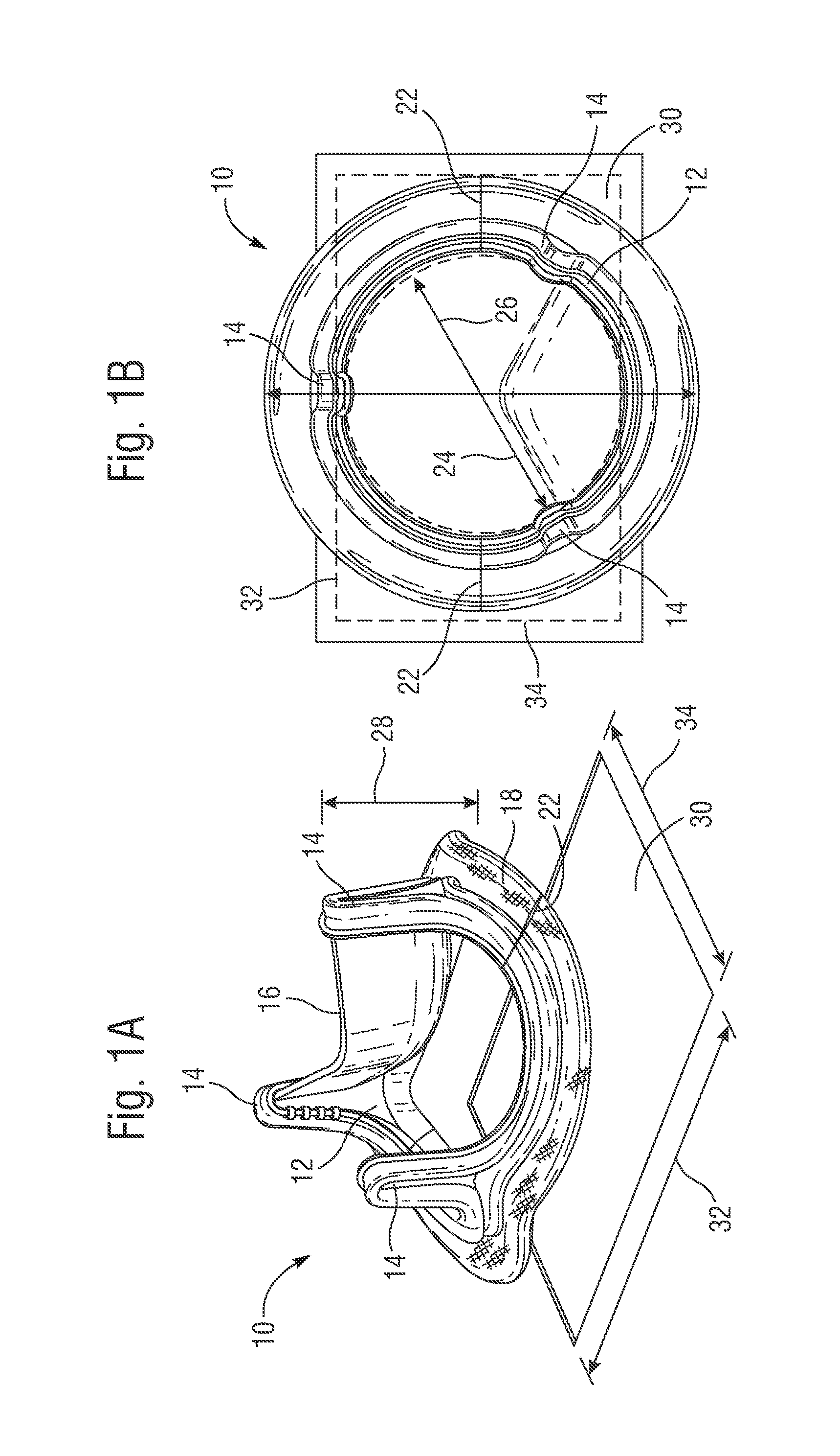 Collapsible cardiac implant and deployment system and methods
