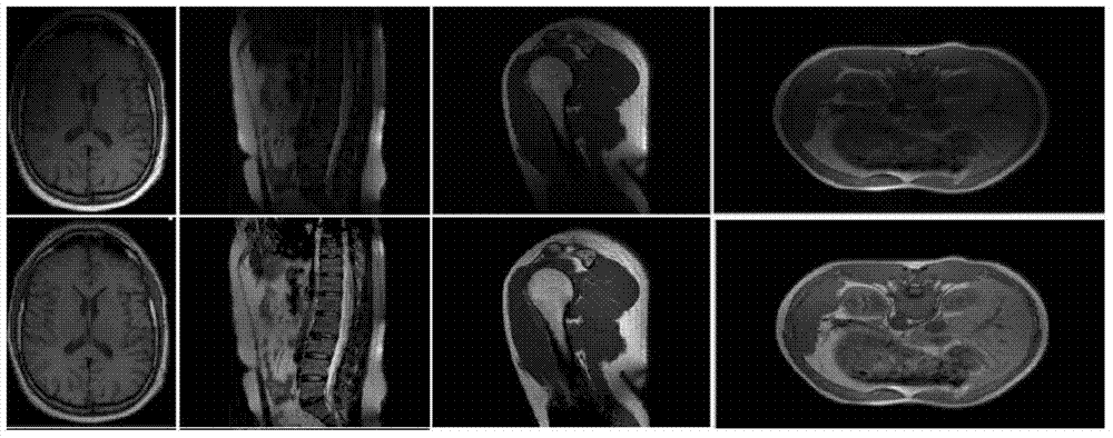 An MRI Inhomogeneous Field Estimation Method Based on Image Gradient Fitting
