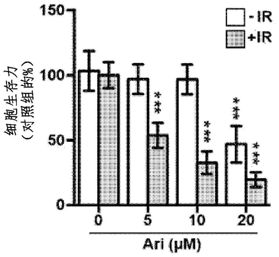 Radiation sensitivity enhancing composition containing aripiprazole as active ingredient