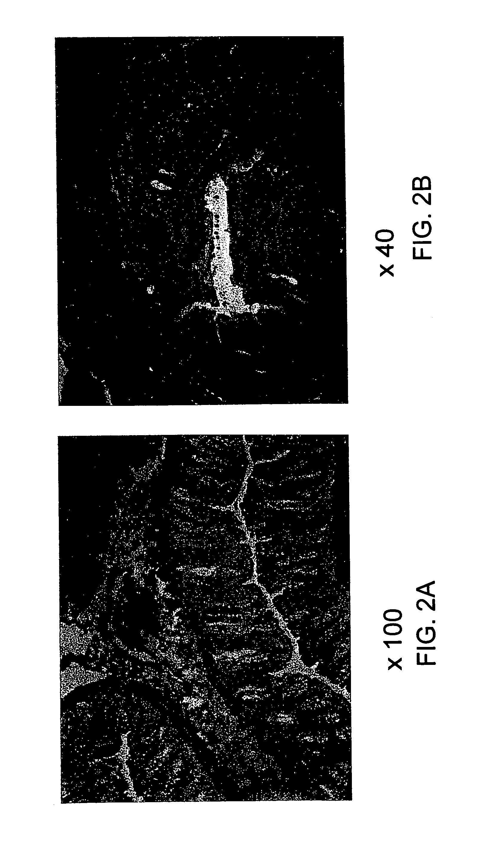 Soft tissue and bone augmentation and bulking utilizing muscle-derived progenito compositions, and treatments thereof