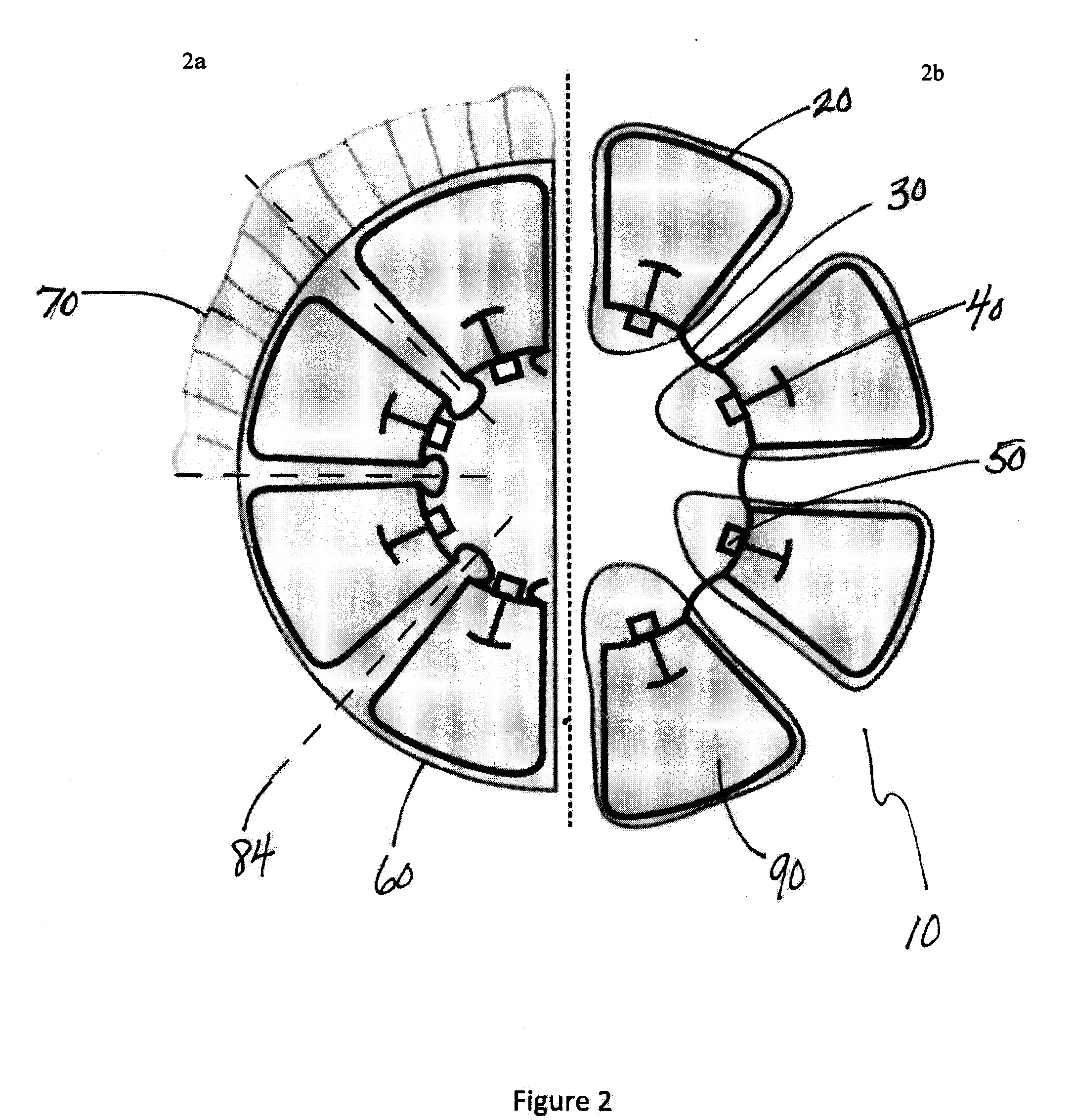 Accommodative intraocular lens and method of improving accommodation