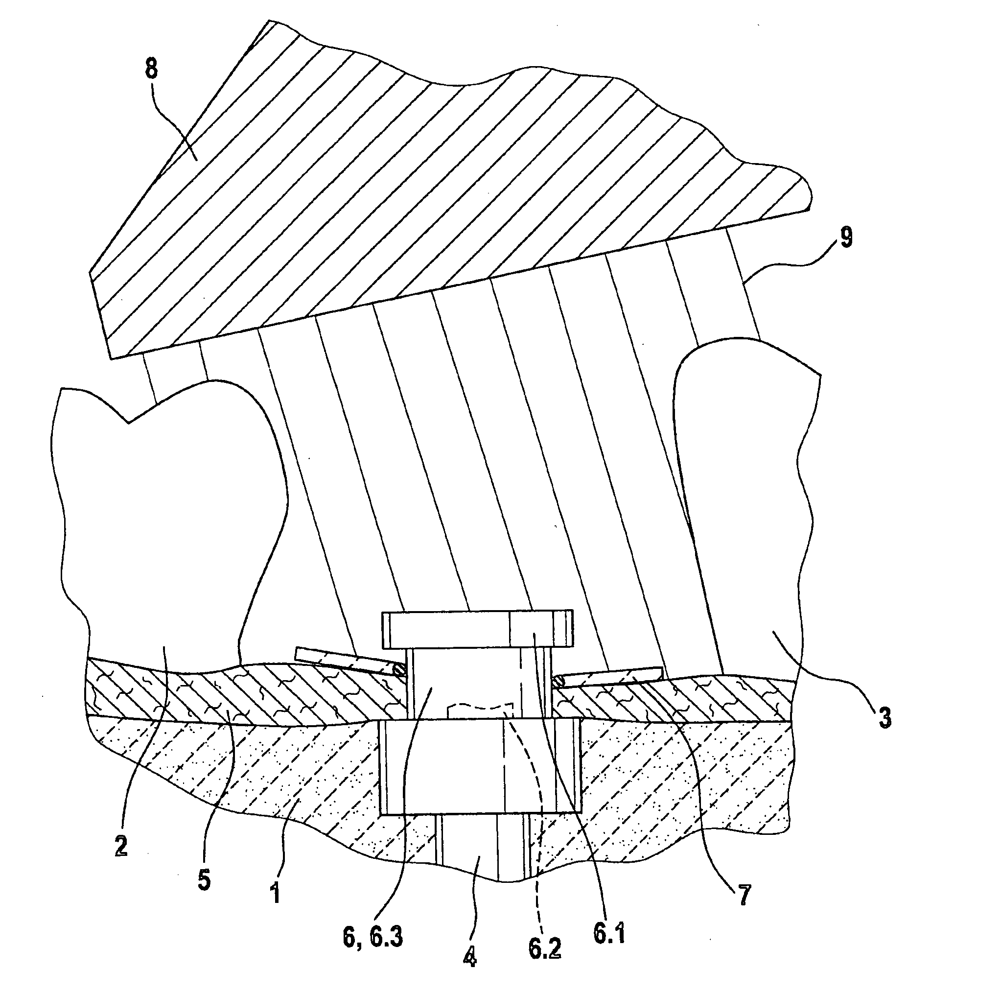 Equalizing device and method of measurement in teeth restorations