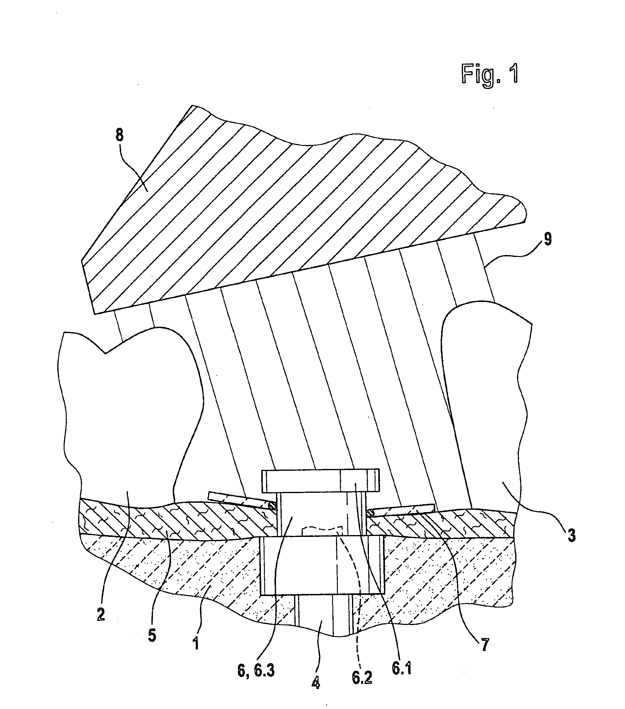 Equalizing device and method of measurement in teeth restorations