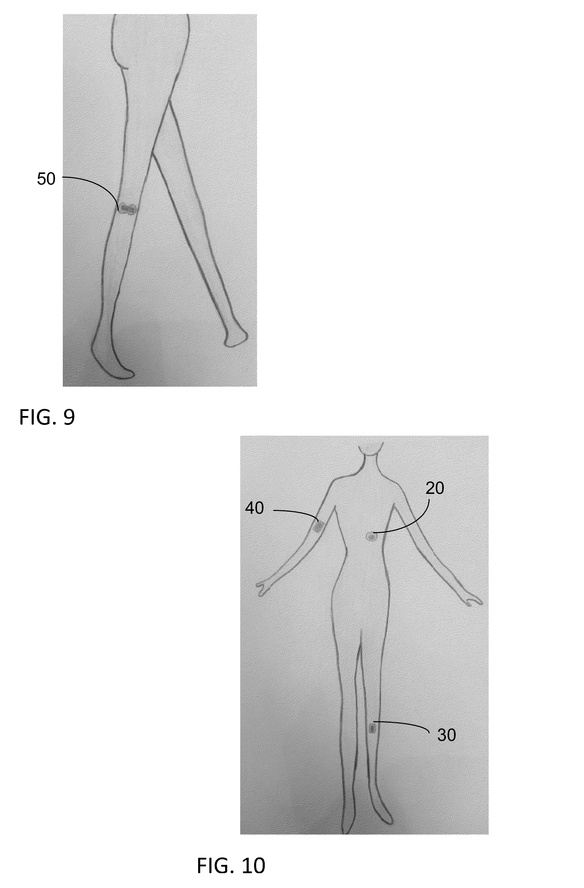 Kit containing patches and composition for insect bite treatment