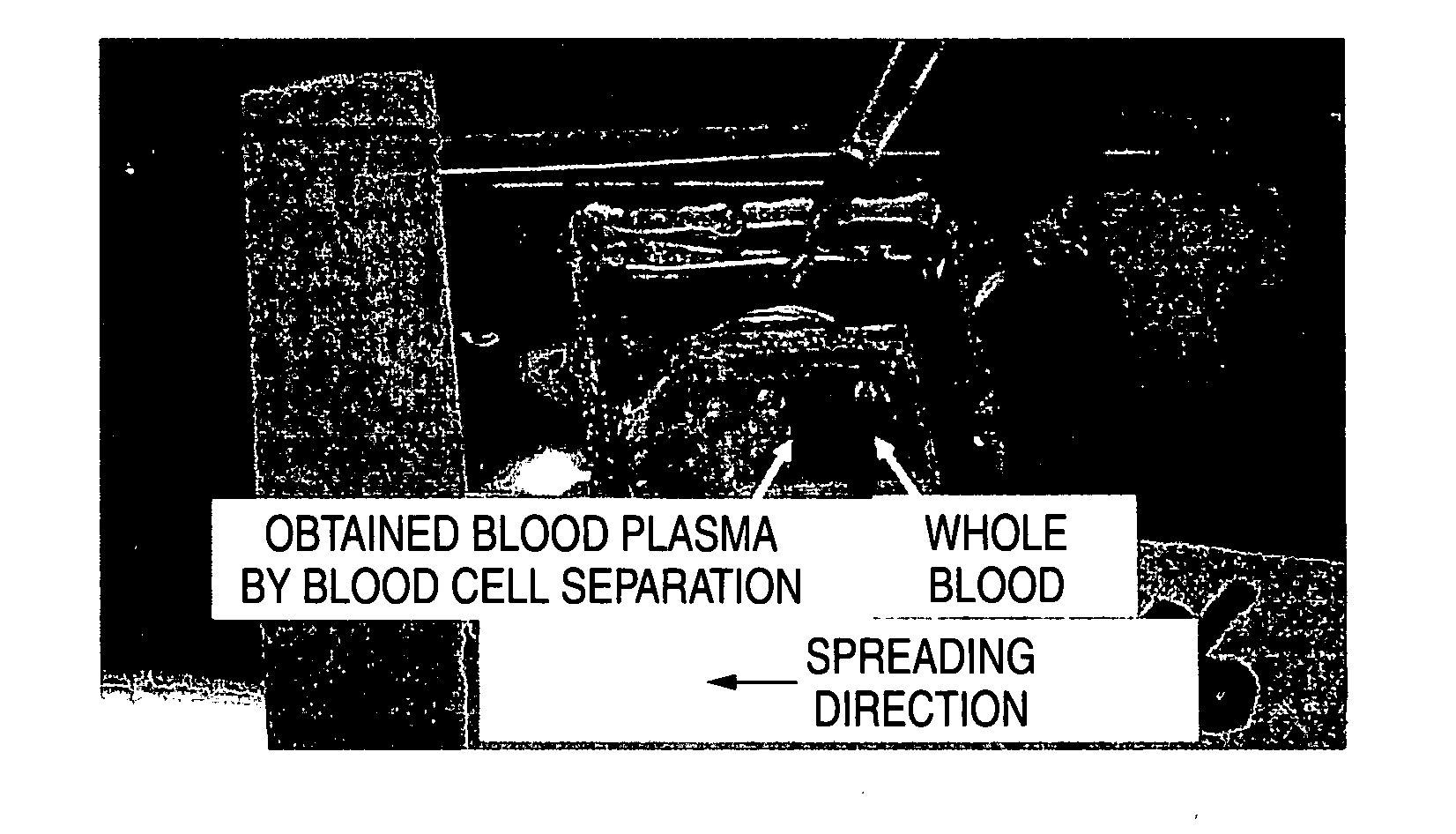 Filter for separating blood cells