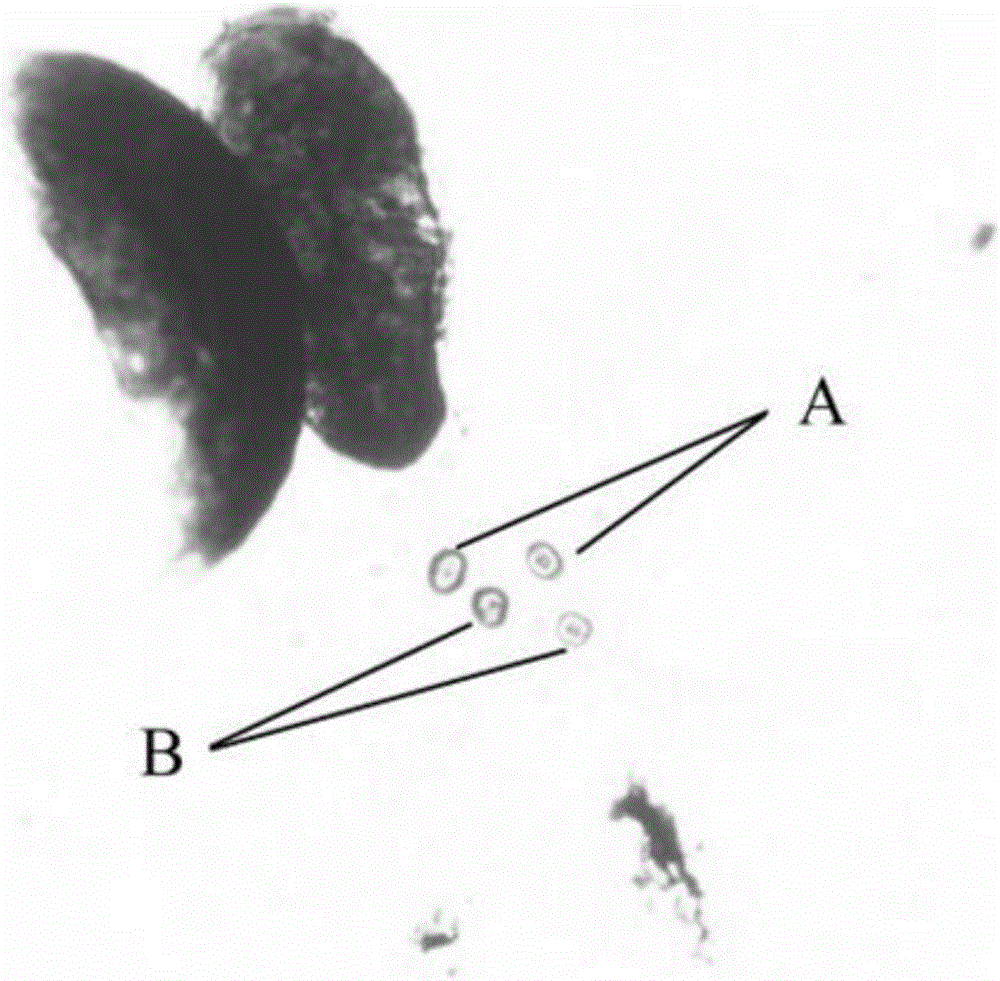 Method for preparing otolith sample for early life history of fish