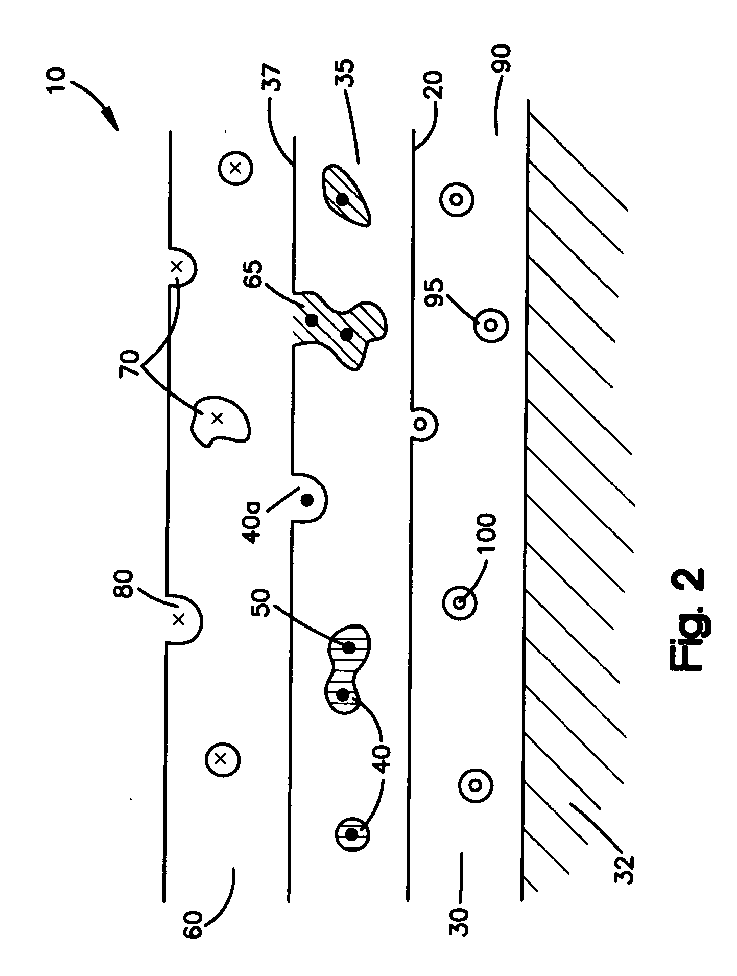Medical devices comprising a porous metal oxide or metal material and a polymer coating for delivering therapeutic agents
