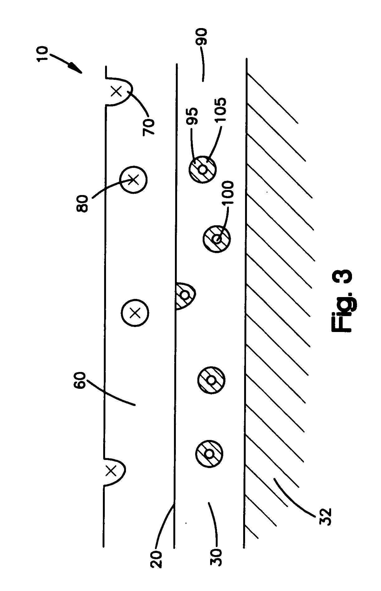 Medical devices comprising a porous metal oxide or metal material and a polymer coating for delivering therapeutic agents