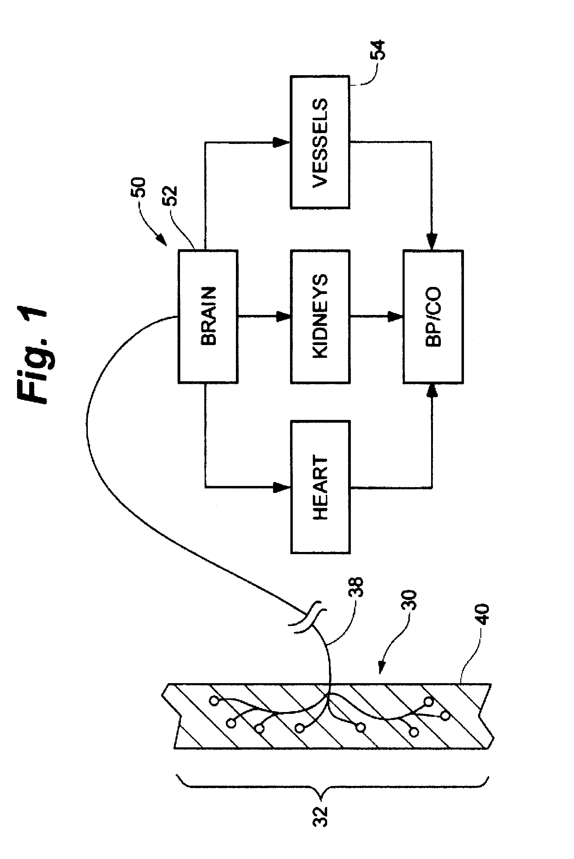 Adapter for connection to pulse generator