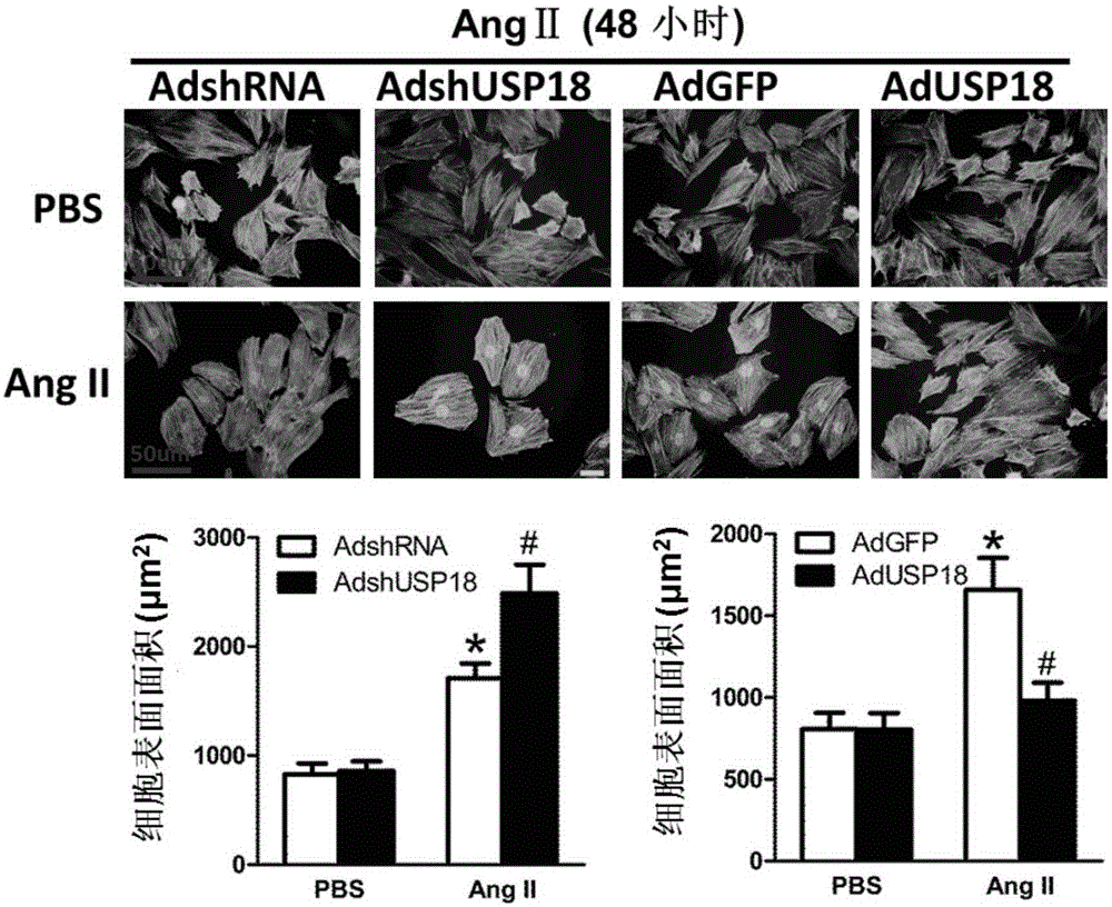 Function and application of ubiquitin-specific protease 18 (USP18) on treatment of cardiac hypertrophy