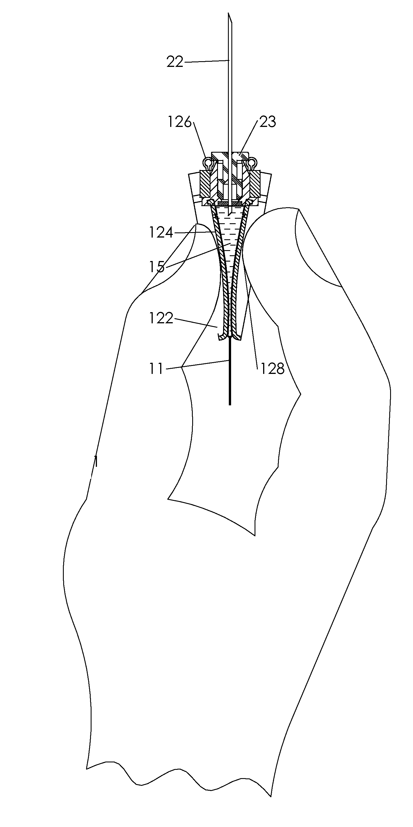 Dispenser and therapeutic package suitable for administering a therapeutic substance to a subject, along with method relating to same