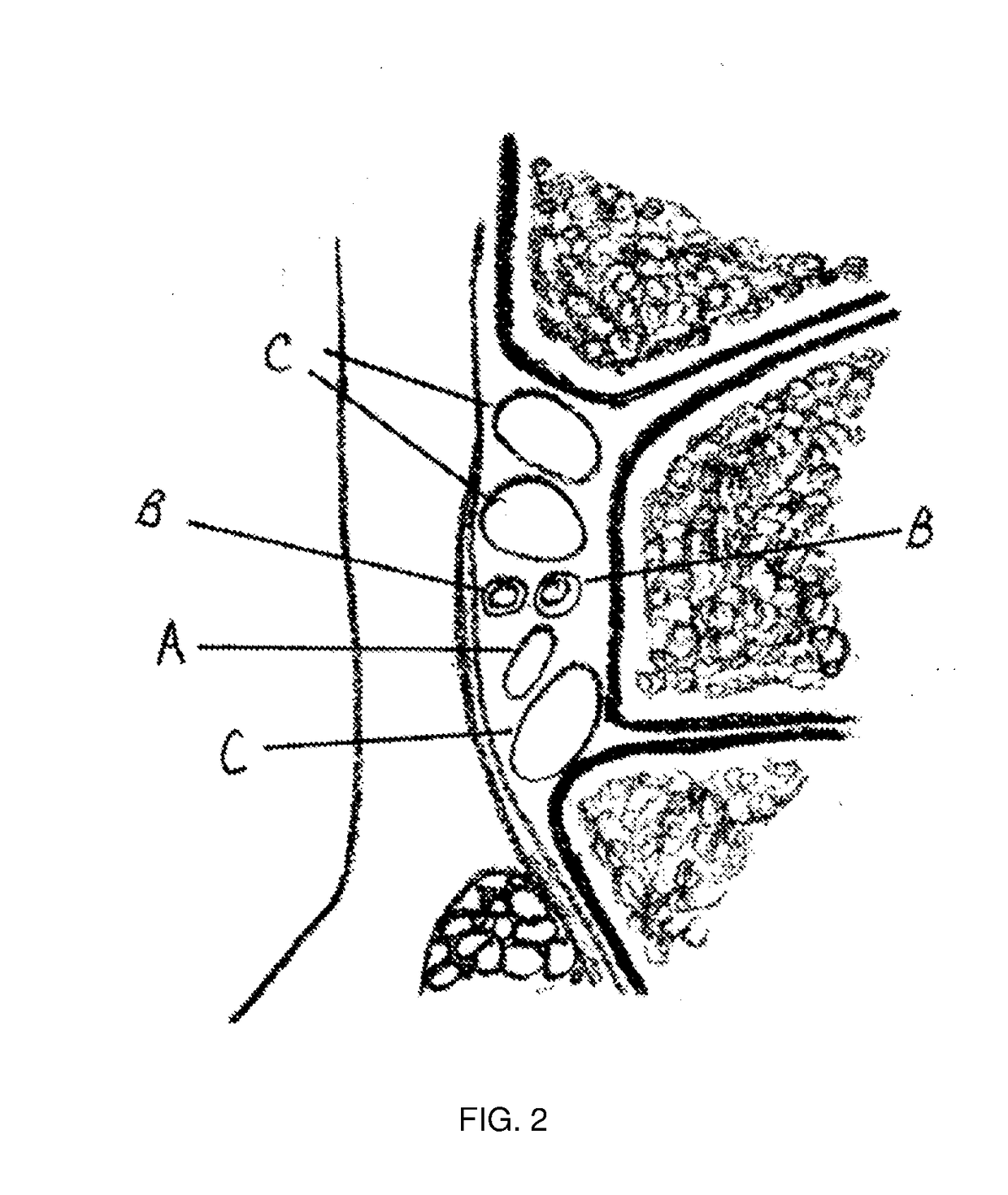 Methods And Compositions For Treating Foot Or Hand Pain