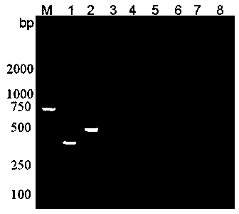 Bacillus erysipelatos-suis PCR (Polymerase Chain Reaction) primer and application thereof