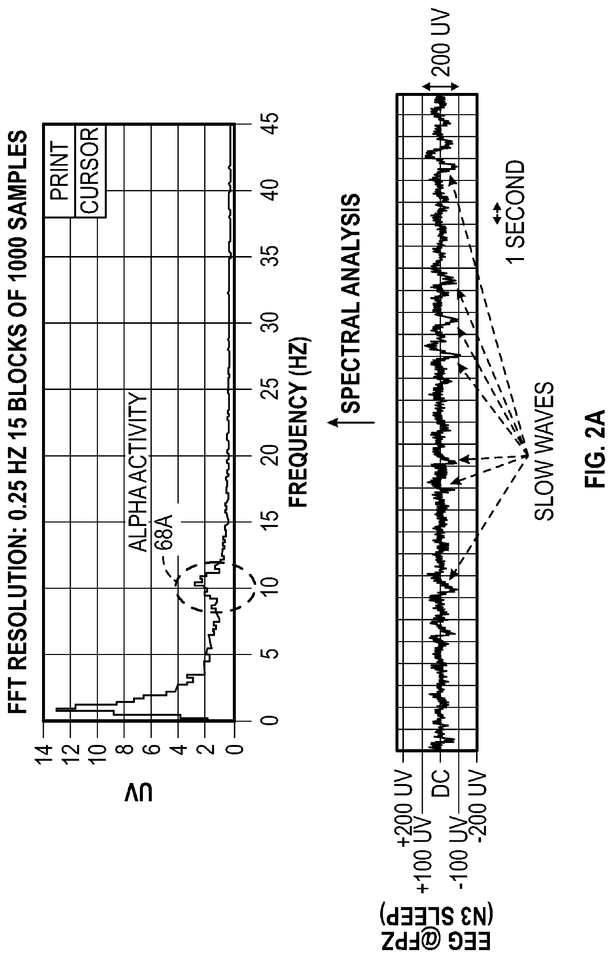 Macro/micro-structure of sleep and similar states of consciousness to optimize pain treatment