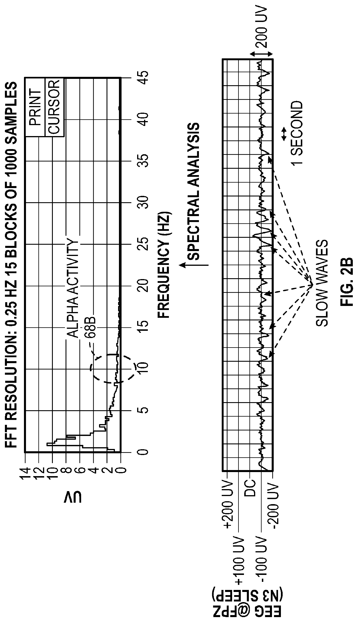 Macro/micro-structure of sleep and similar states of consciousness to optimize pain treatment