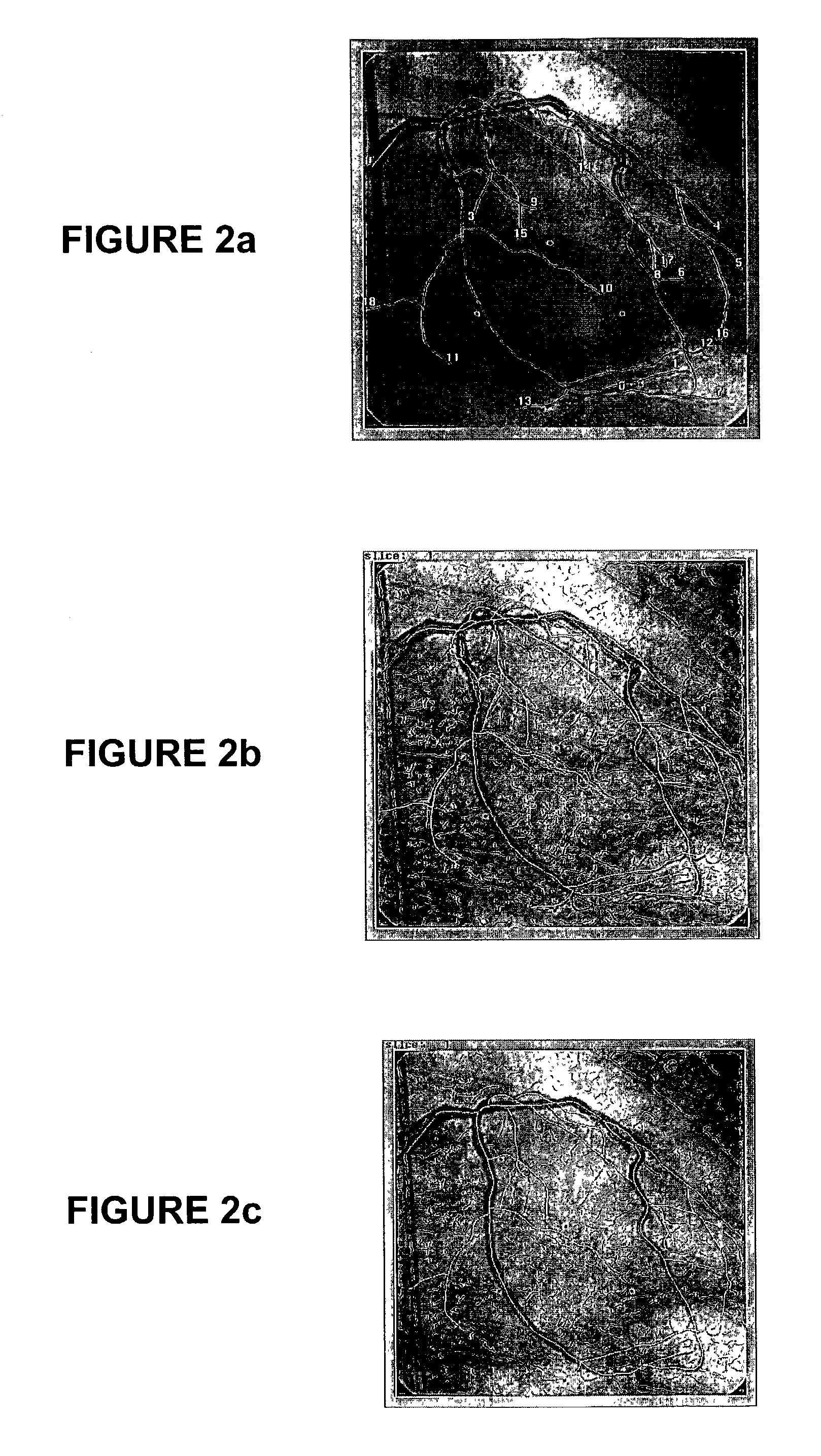 Methods and systems for display and analysis of moving arterial tree structures