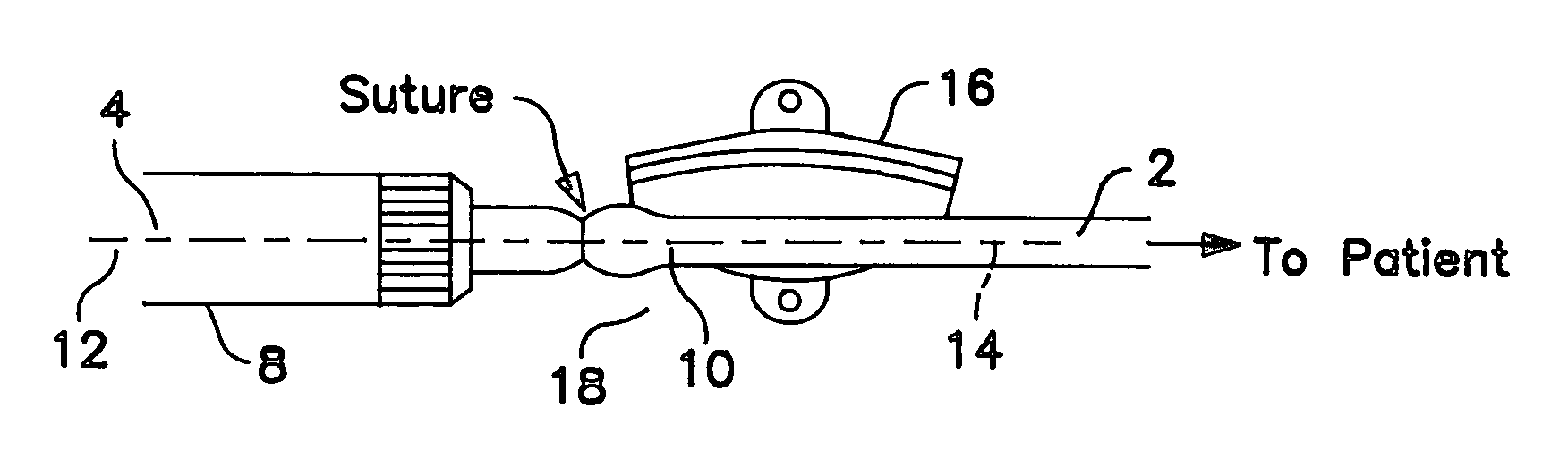 Device used to connect an external ventricular drainage catheter
