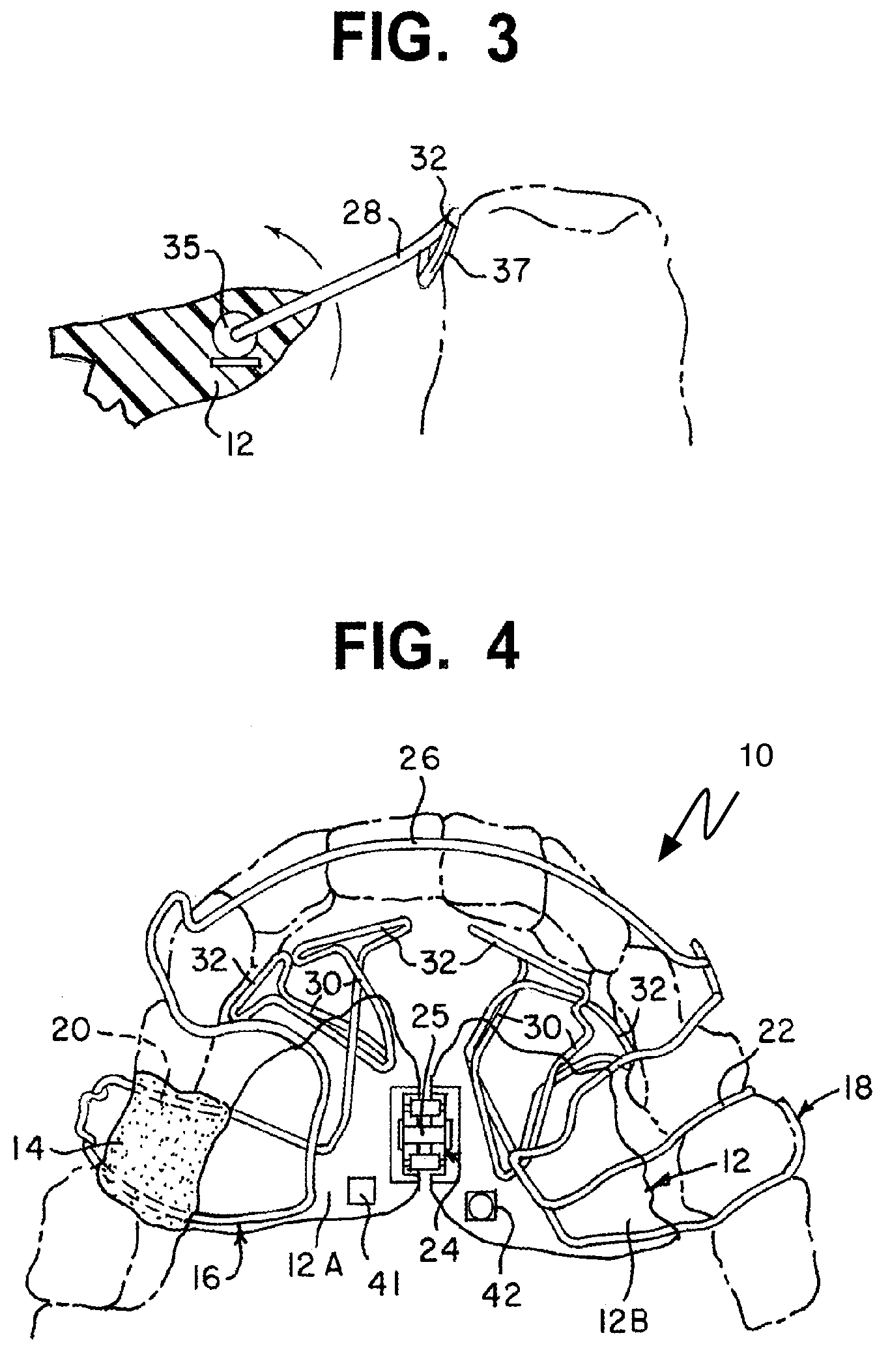 System and method to bioengineer facial form in adults