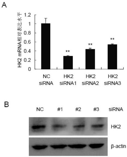 Breast cancer cell line with low expression of HK2 and siRNA used by same