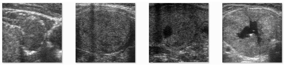 Thyroid nodule automatic grading method and system