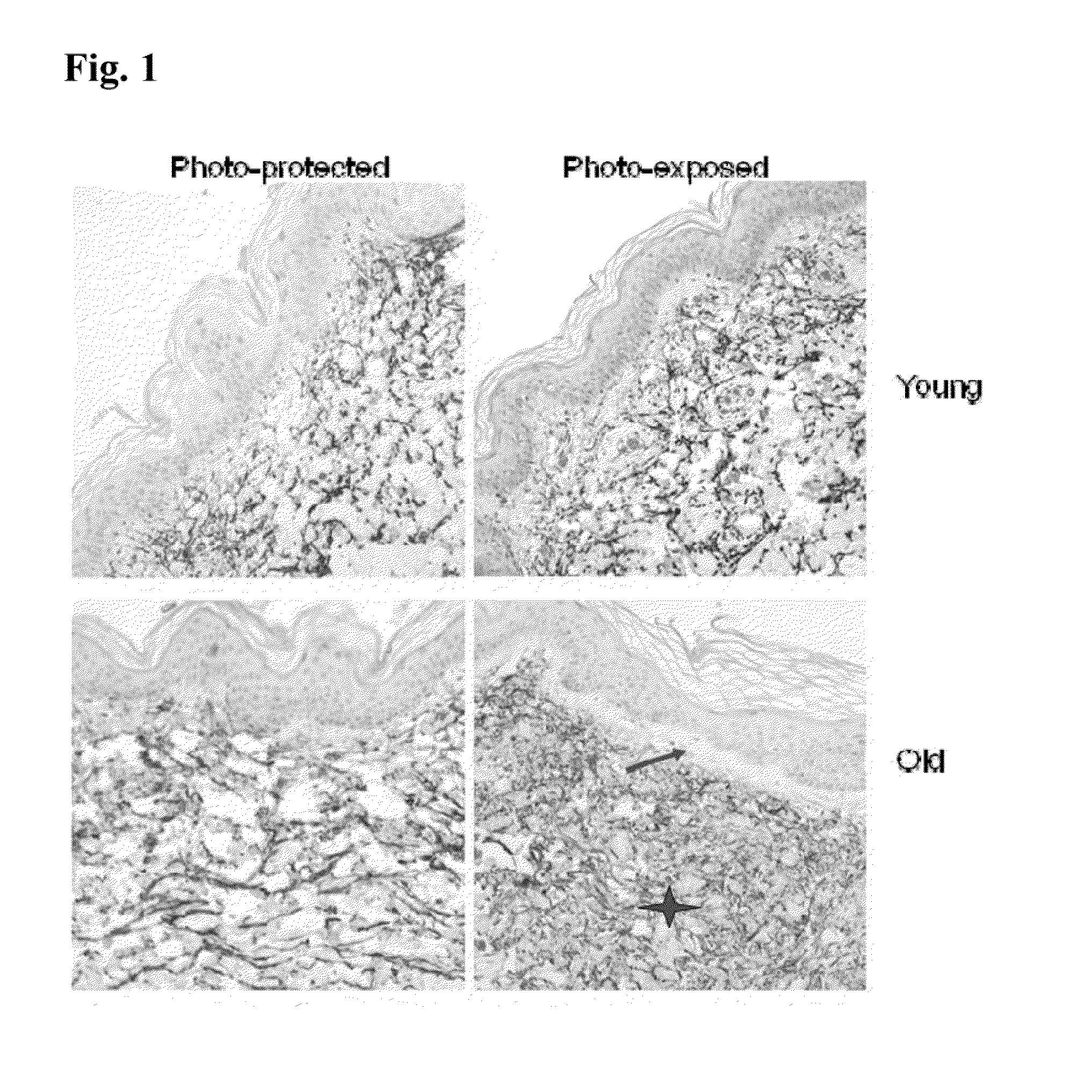 Compositions and Methods for Stimulation MAGP-1 to Improve the Appearance of Skin