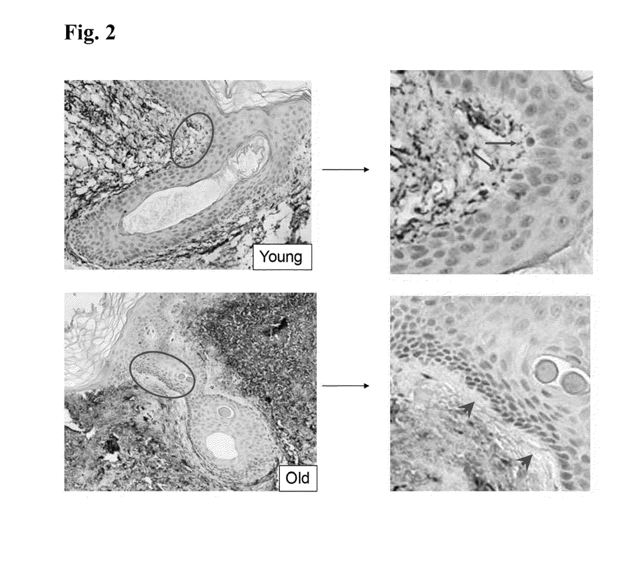Compositions and Methods for Stimulation MAGP-1 to Improve the Appearance of Skin
