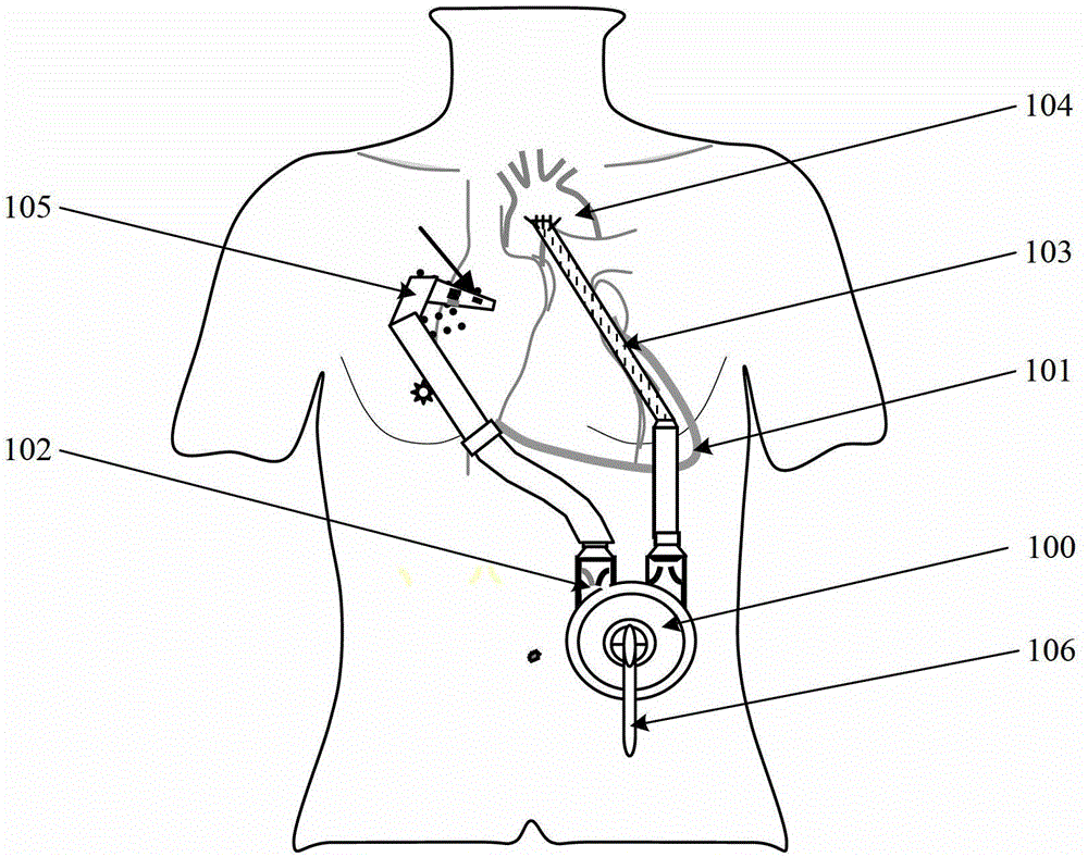 Cardiac impulse assist system