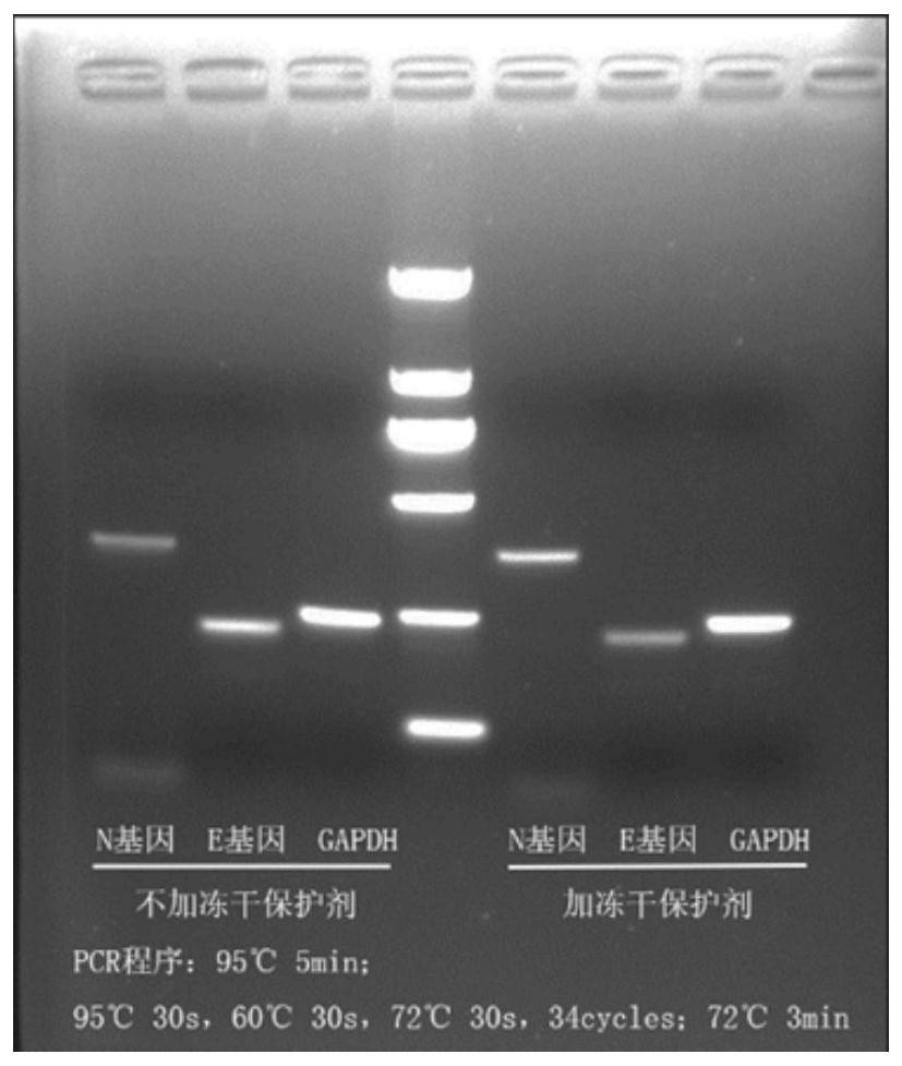 Novel freeze-drying detection reagent for coronavirus nucleic acid and preparation method thereof