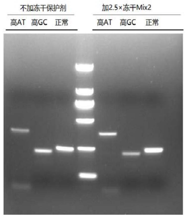 Novel freeze-drying detection reagent for coronavirus nucleic acid and preparation method thereof