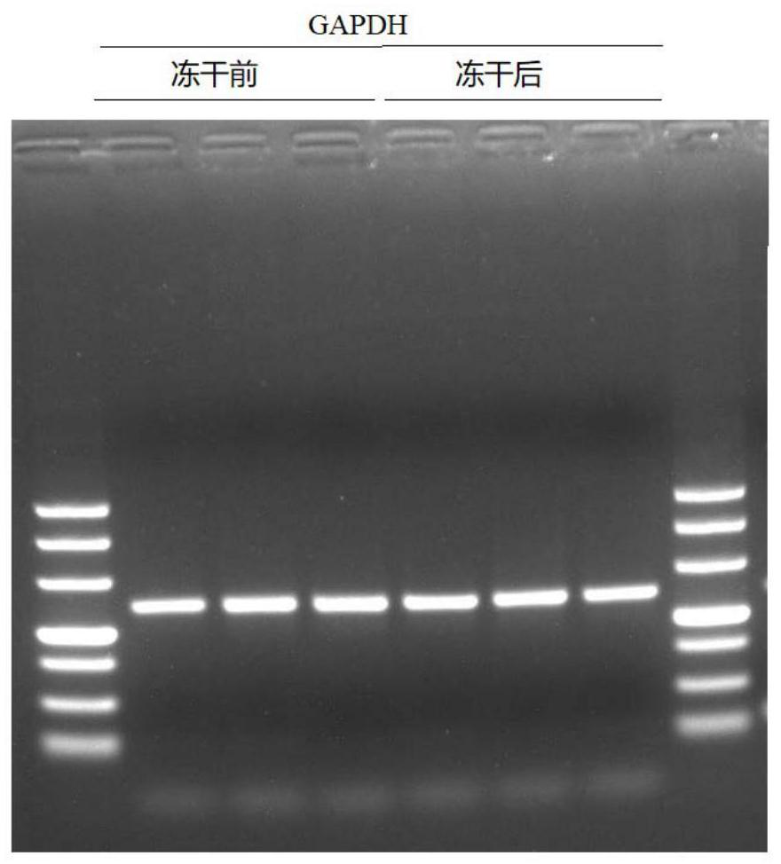 Novel freeze-drying detection reagent for coronavirus nucleic acid and preparation method thereof