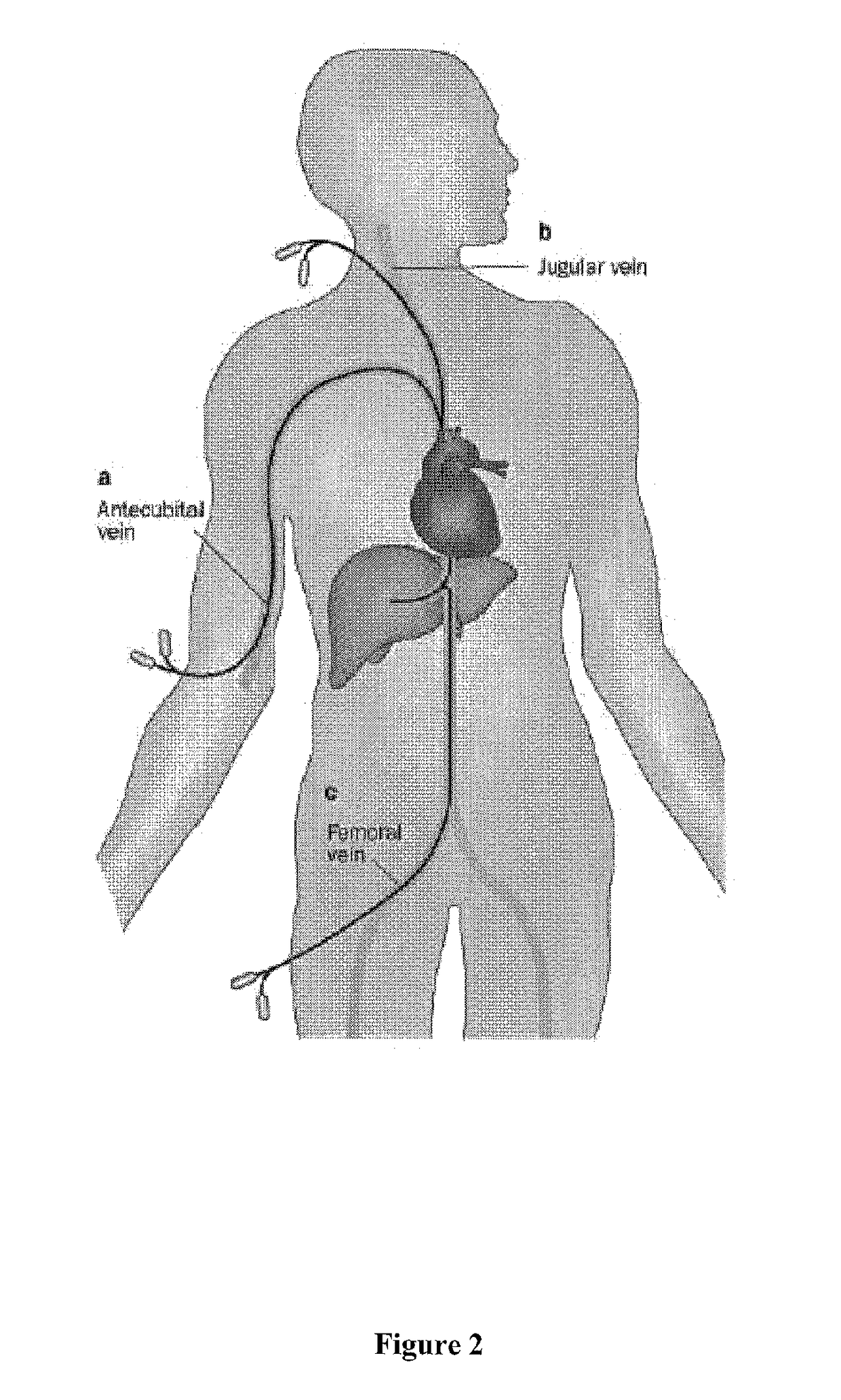 Venous access catheters and methods for portal venous system catheterization