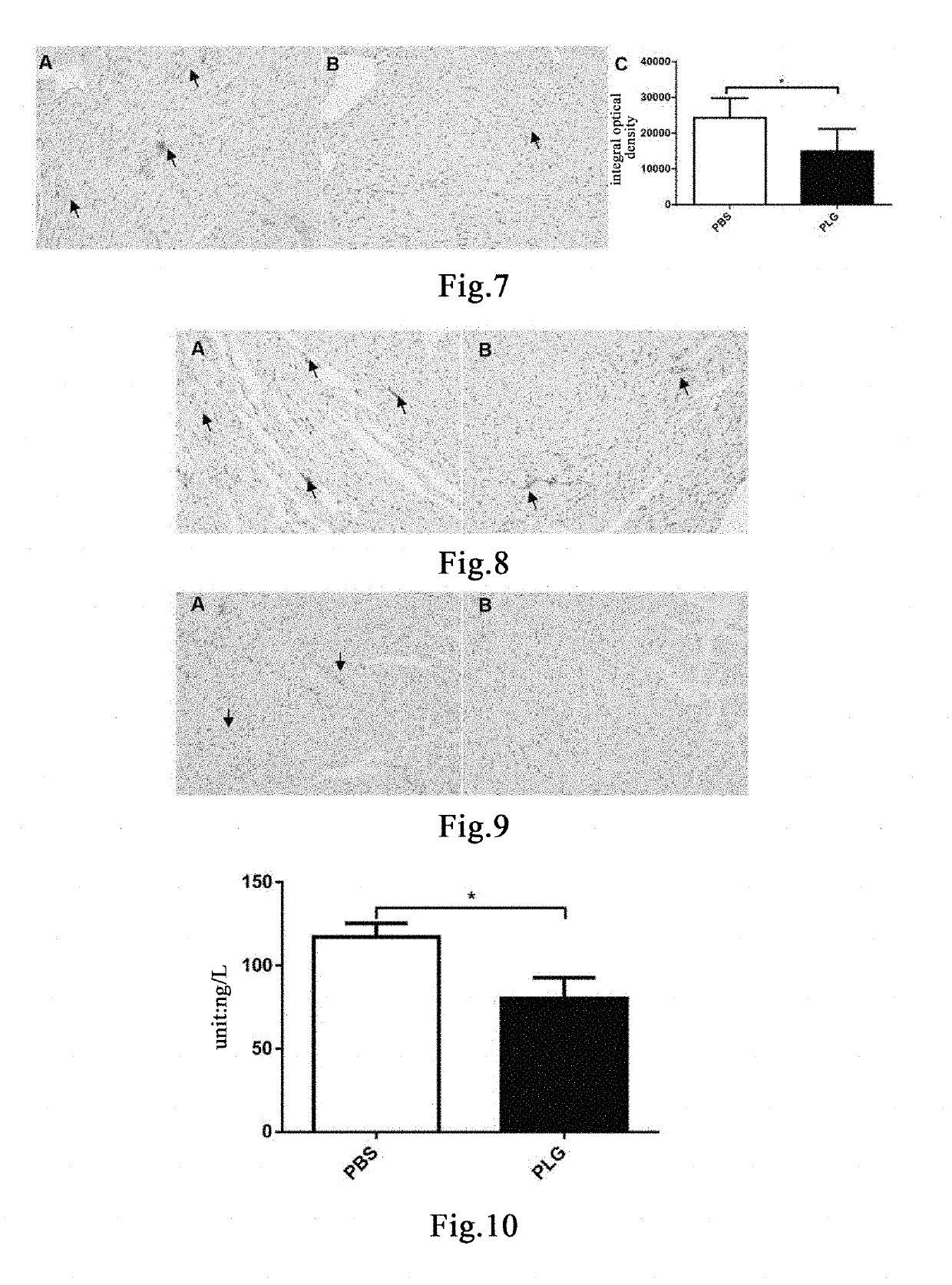Method for preventing and treating lipid metabolism disorders and related diseases thereof